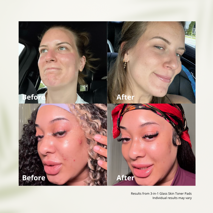 Glass Skin Toner Pads — Hydrate, Brighten & Calm Sensitive Skin